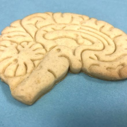 brain-7972277_1280 brain-7972277_1280